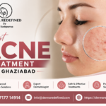 Acne Treatment in Ghaziabad