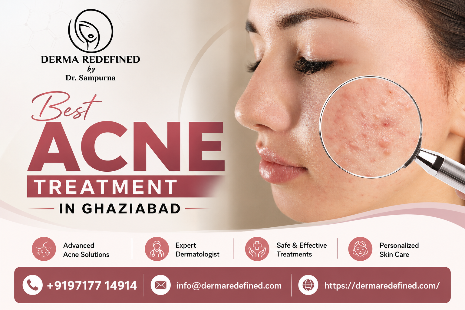 Acne Treatment in Ghaziabad