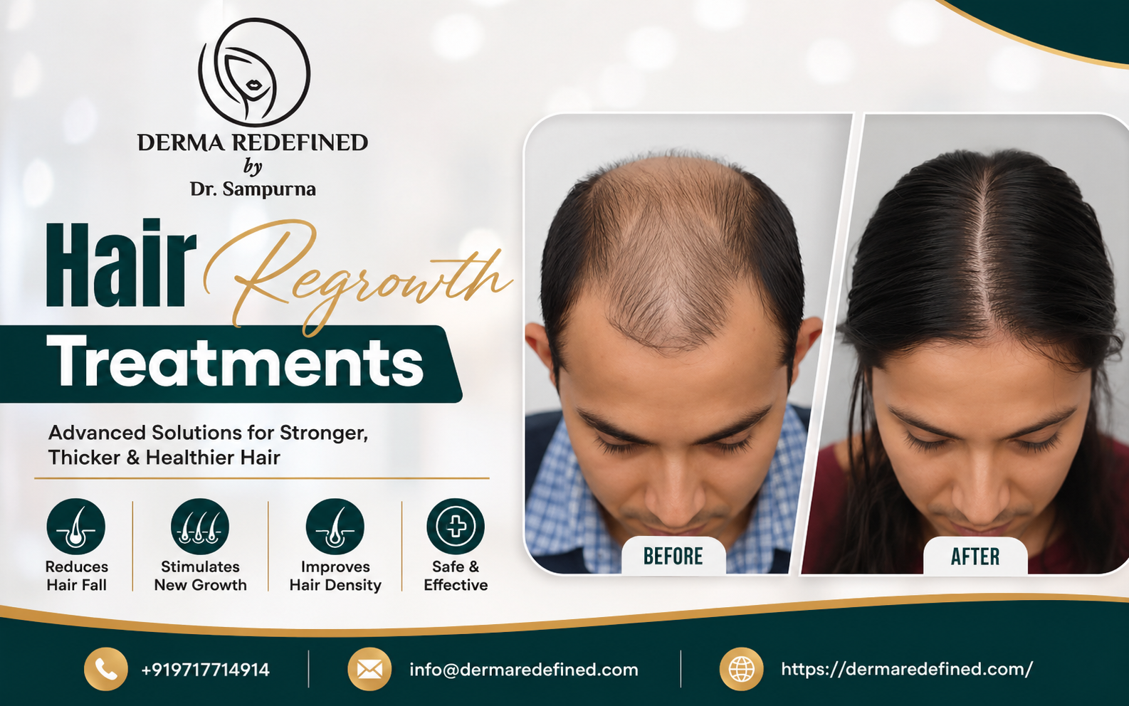 Hair Regrowth Treatments
