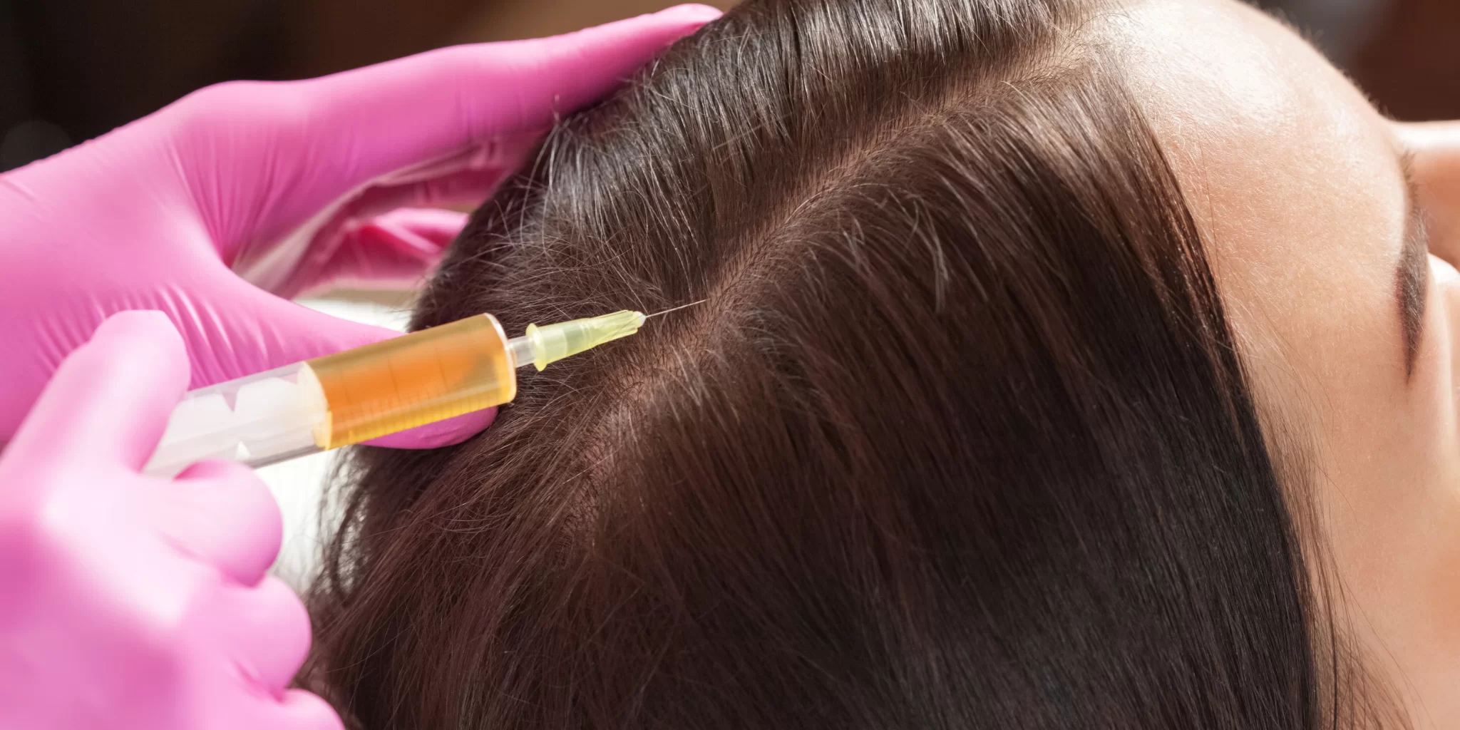 GFC Hair Treatment in Ghaziabad