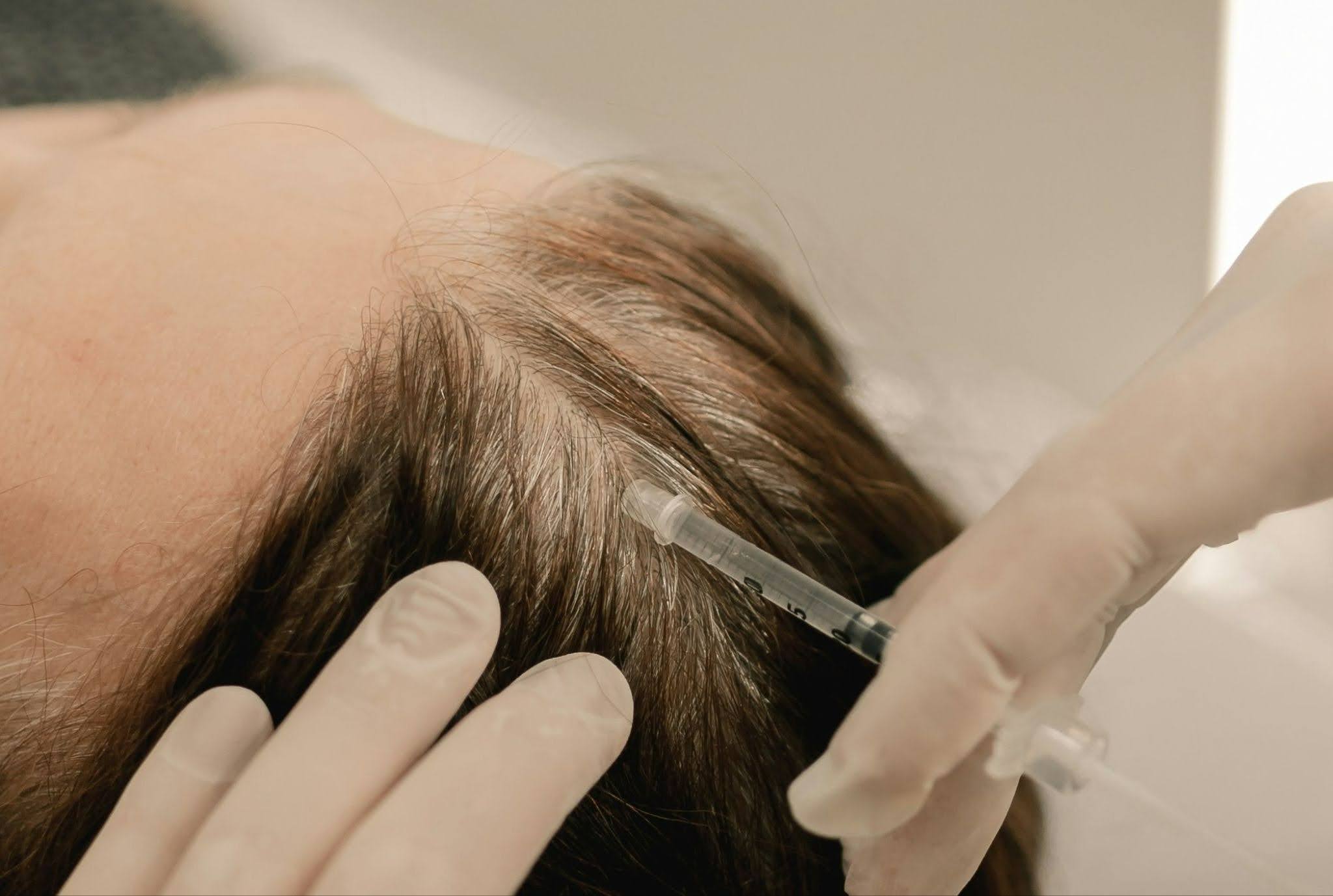 PRP Treatment In Ghaziabad